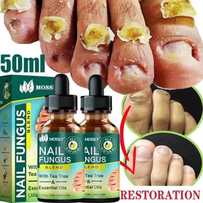 NAIL GROWTH & REPAIR SERUM (BUY 1 GET 1 FREE) (PACK OF 2)